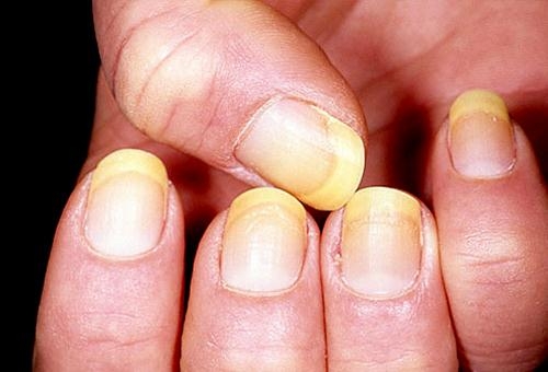 Những tác hại của việc sơn móng tay bạn cần biết 4