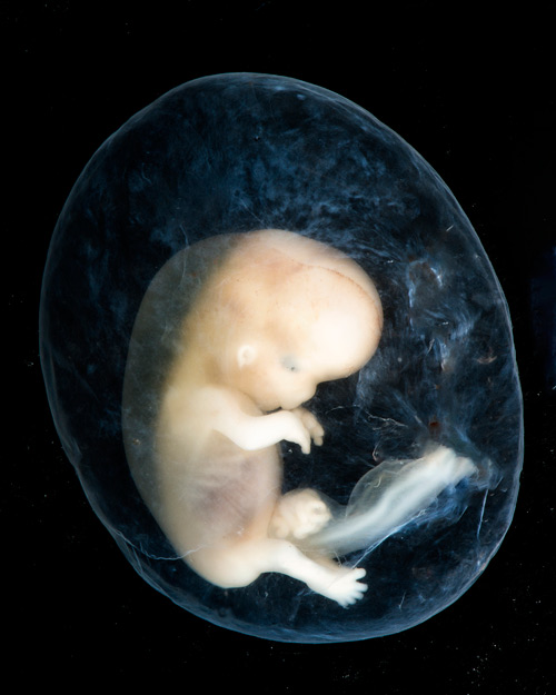 Hình ảnh phôi thai 8-10 tuần tuổi từ khi thụ thai. Phát hiện thú vị nhất là có thể quan sát được cả ruột non của em bé nằm ngoài khoang bụng khi mới hình thành. 