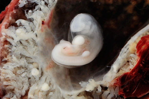 Hình ảnh một phôi thai hình thành ngoài tử cung ước tính khoảng 3-4 tuần tuổi từ lúc thụ thai, dài khoảng 0,5cm.