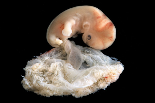 Hình ảnh phôi thai 6-7 tuần và màng ối.
